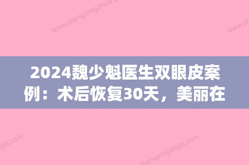 2024魏少魁医生双眼皮案例：术后恢复30天	，美丽在线！(魏少魁有几个修复双眼皮的)