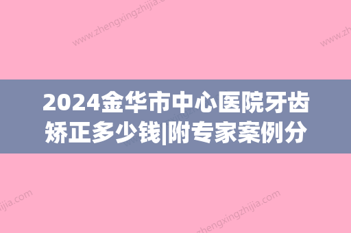 2024金华市中心医院牙齿矫正多少钱|附专家案例分享(金华市中心医院牙科收费标准)