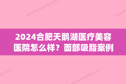 2024合肥天鹅湖医疗美容医院怎么样？面部吸脂案例及果图公布(天鹅湖国际整形)