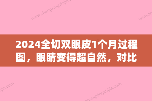 2024全切双眼皮1个月过程图，眼睛变得超自然，对比图分享(全切双眼皮半个月效果图)