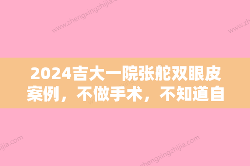 2024吉大一院张舵双眼皮案例，不做手术，不知道自己有多美！