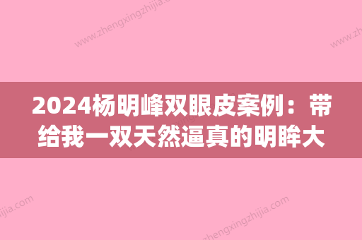 2024杨明峰双眼皮案例：带给我一双天然逼真的明眸大眼(杨明峰整形双眼皮失败)