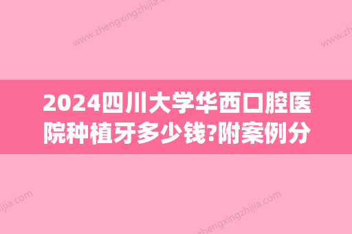 2024四川大学华西口腔医院种植牙多少钱?附案例分享(成都华西口腔医院种牙一颗多少钱)