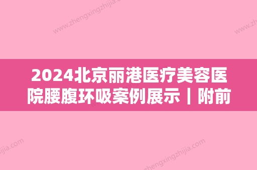 2024北京丽港医疗美容医院腰腹环吸案例展示｜附前后对比图