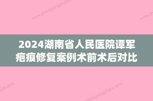 2024湖南省人民医院谭军疤痕修复案例术前术后对比果分享~(湖南谭军疤痕贵吗)