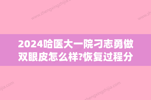 2024哈医大一院刁志勇做双眼皮怎么样?恢复过程分享(哈尔滨医大一院刁志勇双眼皮做的好吗)