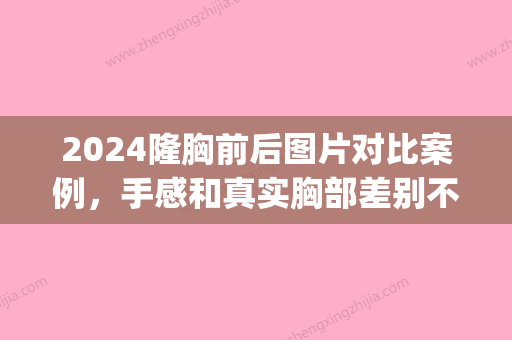 2024隆胸前后图片对比案例，手感和真实胸部差别不大(假体隆胸前后对比图片)