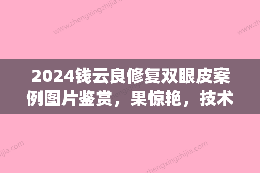 2024钱云良修复双眼皮案例图片鉴赏	，果惊艳，技术精湛(陈海良双眼皮修复案例)