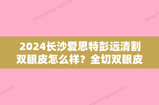 2024长沙爱思特彭远清割双眼皮怎么样？全切双眼皮案例分享