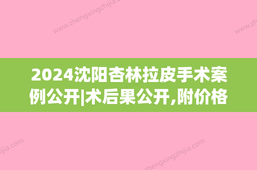 2024沈阳杏林拉皮手术案例公开|术后果公开,附价格表(沈阳杏林拉皮的案例有吗)