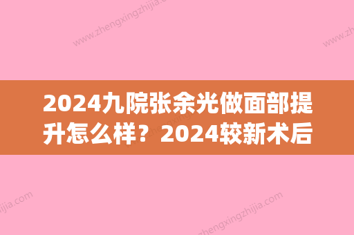 2024九院张余光做面部提升怎么样？2024较新术后果分享(九院张余光面部提升投诉)