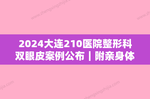 2024大连210医院整形科双眼皮案例公布｜附亲身体验果图