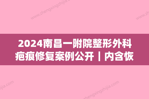 2024南昌一附院整形外科疤痕修复案例公开｜内含恢复细节图(南昌大学第一附属医院疤痕修复)