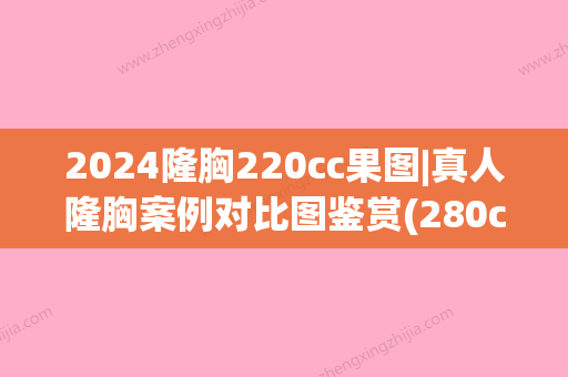 2024隆胸220cc果图|真人隆胸案例对比图鉴赏(280cc假体隆胸案例图片)