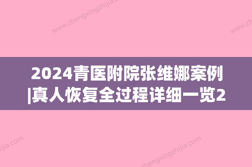 2024青医附院张维娜案例|真人恢复全过程详细一览2024(青医附院美容科张维娜)