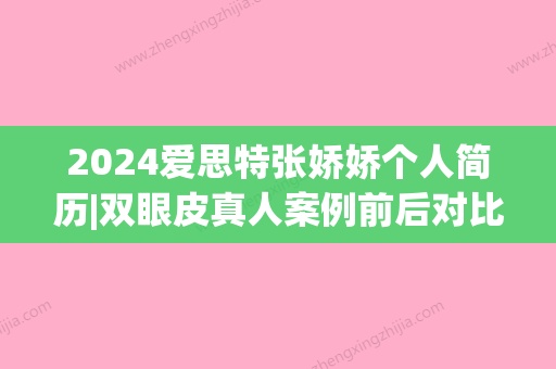 2024爱思特张娇娇个人简历|双眼皮真人案例前后对比图片展示