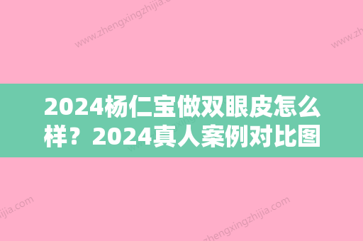 2024杨仁宝做双眼皮怎么样？2024真人案例对比图片分享