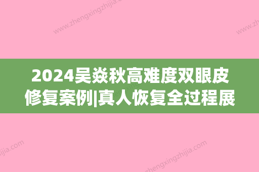 2024吴焱秋高难度双眼皮修复案例|真人恢复全过程展示2024(吴焱秋双眼皮修复好吗?)