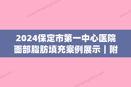 2024保定市第一中心医院面部脂肪填充案例展示｜附亲身体验感悟(保定面部填充价格)