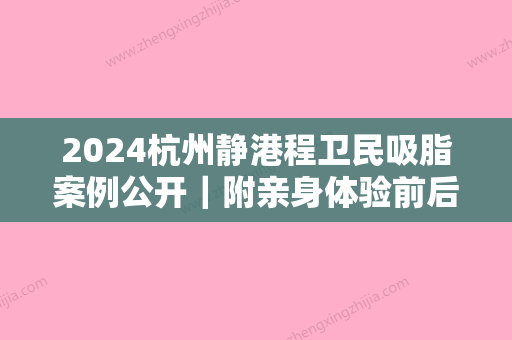 2024杭州静港程卫民吸脂案例公开｜附亲身体验前后对比图