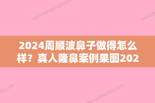 2024周顺波鼻子做得怎么样？真人隆鼻案例果图2024