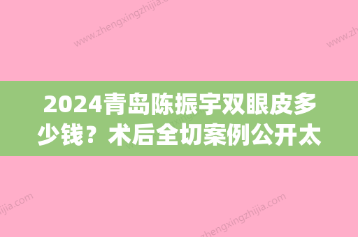 2024青岛陈振宇双眼皮多少钱？术后全切案例公开太自然了(陈振宇做的双眼皮)