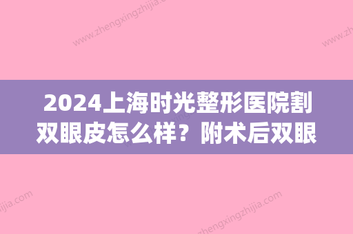 2024上海时光整形医院割双眼皮怎么样？附术后双眼皮美照案例分享(上海时光做双眼皮怎么样)