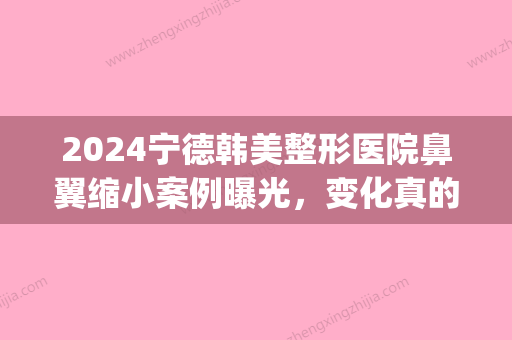 2024宁德韩美整形医院鼻翼缩小案例曝光，变化真的很满意~(韩式鼻子整形前后对比)