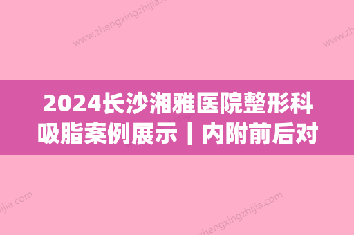 2024长沙湘雅医院整形科吸脂案例展示｜内附前后对比图(长沙湘雅二医院面部吸脂价格)