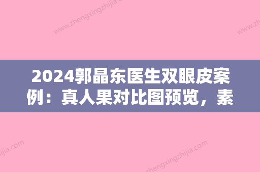 2024郭晶东医生双眼皮案例：真人果对比图预览，素颜很美