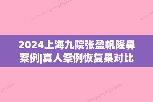 2024上海九院张盈帆隆鼻案例|真人案例恢复果对比图(张盈帆做鼻子价格)