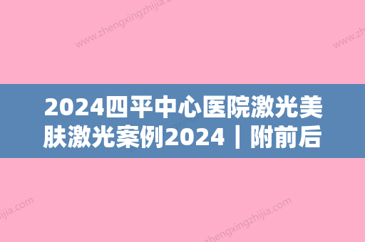 2024四平中心医院激光美肤激光案例2024｜附前后对比图