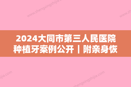 2024大同市第三人民医院种植牙案例公开｜附亲身恢复详版感悟