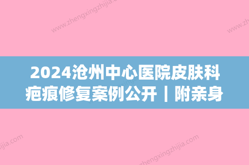 2024沧州中心医院皮肤科疤痕修复案例公开｜附亲身体验前后果图(沧州去疤痕医院专业)