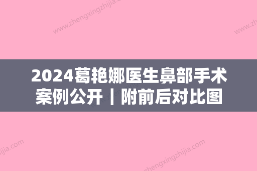 2024葛艳娜医生鼻部手术案例公开｜附前后对比图