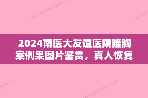 2024南医大友谊医院隆胸案例果图片鉴赏	，真人恢复全过程