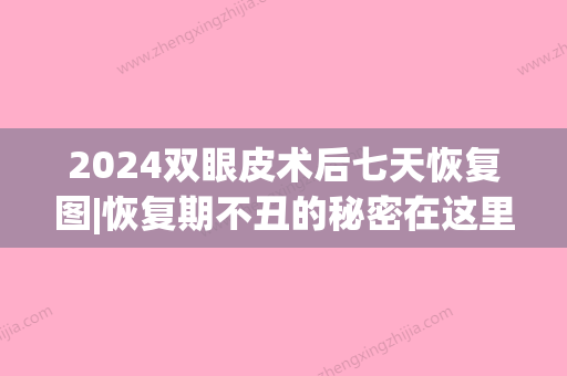 2024双眼皮术后七天恢复图|恢复期不丑的秘密在这里(割双眼皮几天恢复)