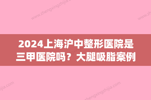 2024上海沪中整形医院是三甲医院吗？大腿吸脂案例分享一览(上海做整形的三甲医院)