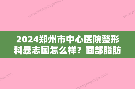 2024郑州市中心医院整形科暴志国怎么样？面部脂肪填充案例分享