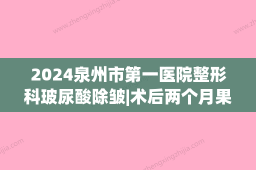 2024泉州市第一医院整形科玻尿酸除皱|术后两个月果分享