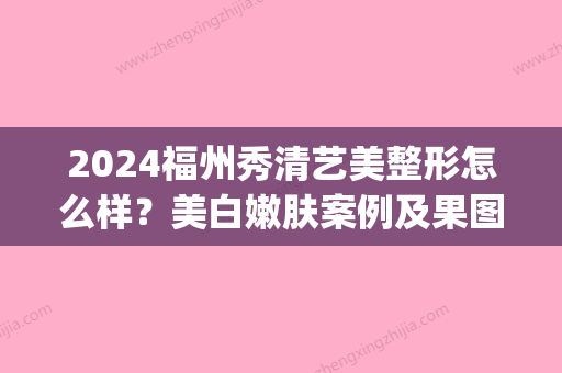 2024福州秀清艺美整形怎么样？美白嫩肤案例及果图公开(福州秀清艺美整形医院)