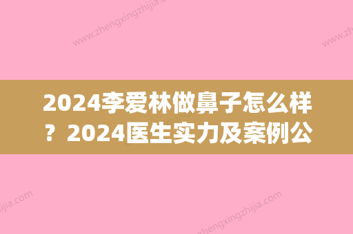 2024李爱林做鼻子怎么样？2024医生实力及案例公布(李爱林鼻综合案例)