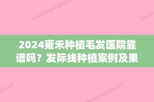 2024雍禾种植毛发医院靠谱吗？发际线种植案例及果图分享(雍禾种植毛发医院正规)