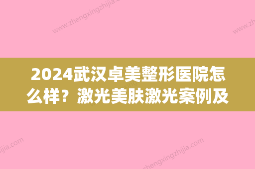 2024武汉卓美整形医院怎么样？激光美肤激光案例及果图分享(武汉卓美医疗美容怎么样)