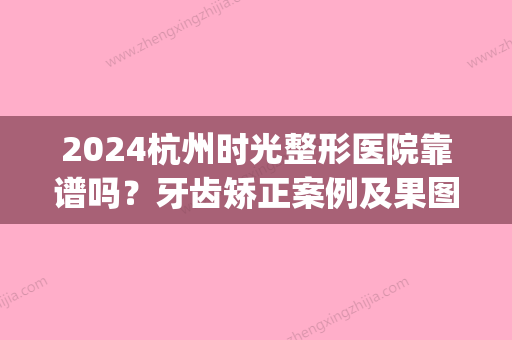 2024杭州时光整形医院靠谱吗？牙齿矫正案例及果图分享(杭州时光医疗美容医院牙科)