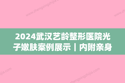 2024武汉艺龄整形医院光子嫩肤案例展示｜内附亲身体验果图(武汉光子嫩肤美莱整形)