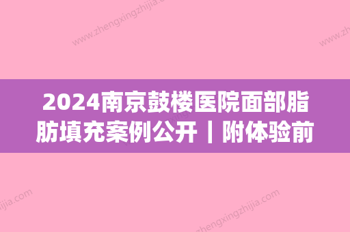 2024南京鼓楼医院面部脂肪填充案例公开｜附体验前后对比图(南京鼓楼医院自体脂肪填充)