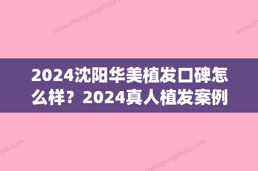 2024沈阳华美植发口碑怎么样？2024真人植发案例分享(沈阳华美植发研究院)