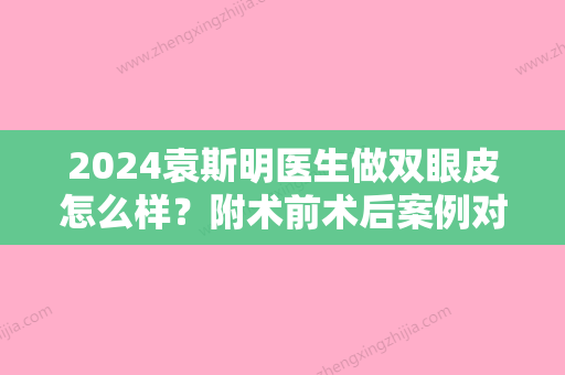 2024袁斯明医生做双眼皮怎么样？附术前术后案例对比一览