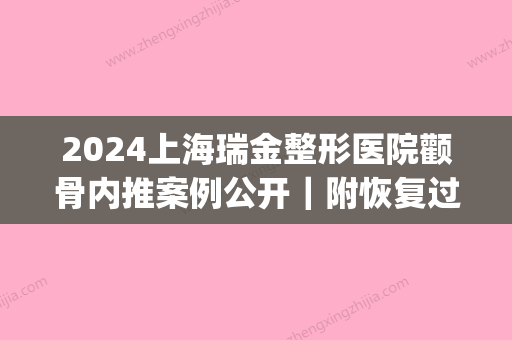 2024上海瑞金整形医院颧骨内推案例公开｜附恢复过程细节图(颧骨内推术后)